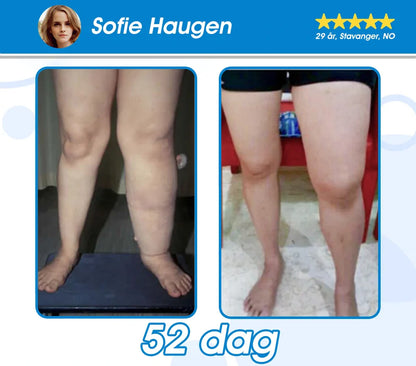 Offisielt autorisert butikk -𝘗𝘌𝘈𝘒𝘈® 𝘎𝘓𝘗-1 𝘚𝘭𝘢𝘯𝘬𝘦𝘯𝘥𝘦 & 𝘏𝘦𝘭𝘴𝘦 𝘜𝘭𝘵𝘳𝘢 𝘒𝘰𝘯𝘴𝘦𝘯𝘵𝘳𝘦𝘳𝘵 𝘌𝘴𝘴𝘦𝘯𝘴𝘷æ𝘴𝘬𝘦𝘱𝘦𝘳𝘭𝘦𝘳 – 𝘕𝘈𝘋+ 𝘔𝘰𝘳𝘪𝘯𝘨𝘢 & 𝘌𝘱𝘭𝘦𝘤𝘪𝘥𝘦𝘳𝘦𝘥𝘥𝘪𝘬 & 𝘒𝘦𝘵𝘰 𝘉𝘏𝘉 (✅ rask, langvarig effekt, adresserer diabetes, fedme og hjerte- og karsykdommer) ⚡Utviklet av The Obesity Society