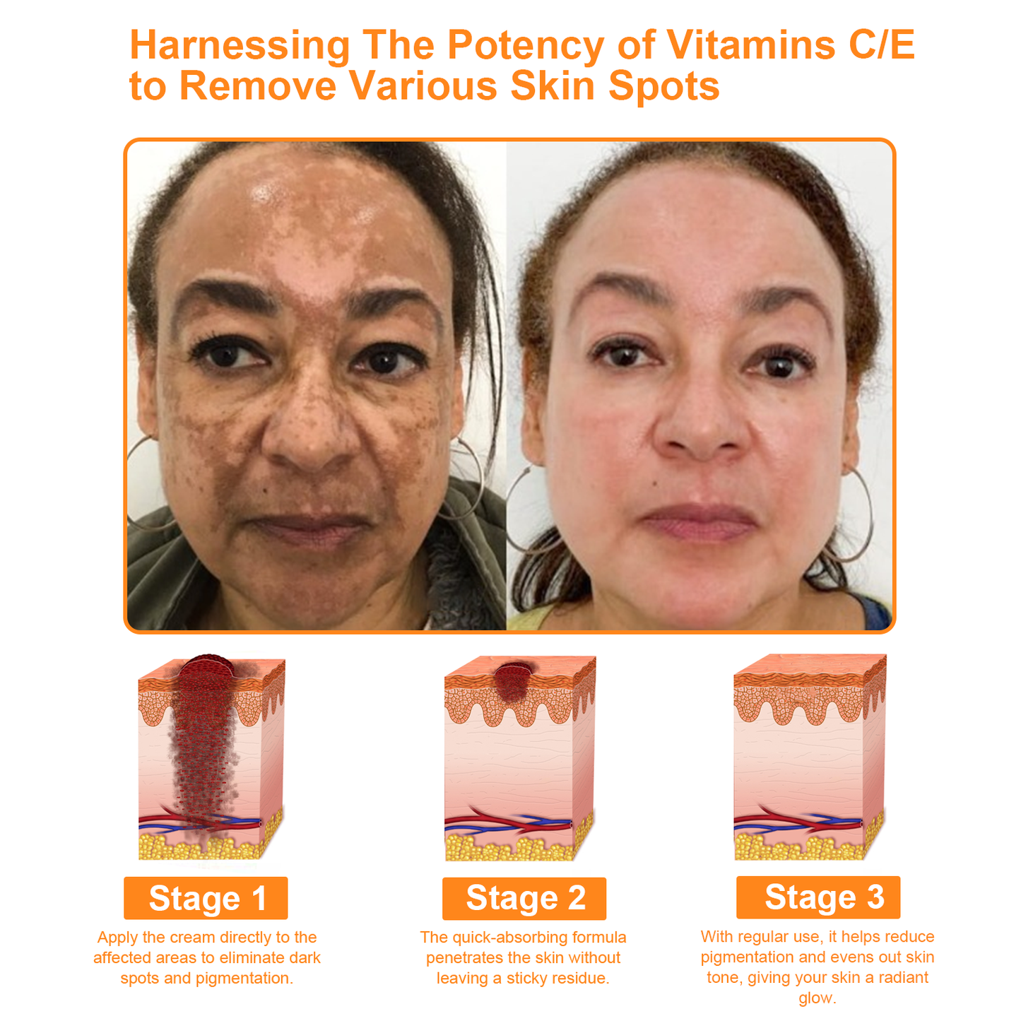 𝐓𝐧𝐧𝐞𝐝𝐞𝐲® 7-Day Multi-Effect All-in-One Skincare Cream [AAD Recommended]🌻🧖‍♀️