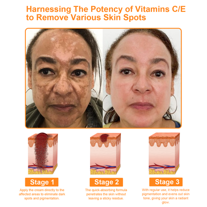 𝐓𝐧𝐧𝐞𝐝𝐞𝐲® 7-Day Multi-Effect All-in-One Skincare Cream [AAD Recommended]🌻🧖‍♀️