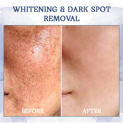 𝐋𝐚𝐬𝐭 𝐃𝐚𝐲 𝐃𝐢𝐬𝐜𝐨𝐮𝐧𝐭: ✨🩵𝟕𝟎% 𝐎𝐅𝐅🌸𝐅𝐮𝐛𝐬𝐭𝐚® 𝐀𝐝𝐯𝐚𝐧𝐜𝐞𝐝 𝐅𝐢𝐫𝐦𝐢𝐧𝐠 & 𝐖𝐫𝐢𝐧𝐤𝐥𝐞-𝐑𝐞𝐝𝐮𝐜𝐢𝐧𝐠 𝐂𝐫𝐞𝐚𝐦: Restore Skin Elasticity⭐