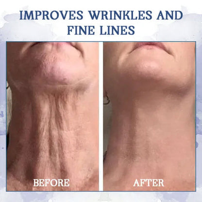 𝐋𝐚𝐬𝐭 𝐃𝐚𝐲 𝐃𝐢𝐬𝐜𝐨𝐮𝐧𝐭: 𝟕5% 𝐎𝐅𝐅 - 𝐅𝐮𝐛𝐬𝐭𝐚® Advanced Firming & Wrinkle-Reducing Cream: Restore Skin Elasticity