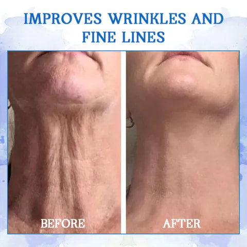 𝐅𝐢𝐧𝐚𝐥 𝐃𝐚𝐲 𝐒𝐚𝐯𝐢𝐧𝐠𝐬: 7𝟎% 𝐎𝐅𝐅🌐𝐅𝐮𝐛𝐬𝐭𝐚® Ultra Firming & Revitalizing Cream: Renew Skin Firmness💦