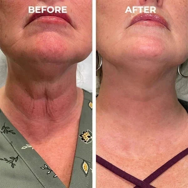 𝐋𝐚𝐬𝐭 𝐃𝐚𝐲 𝐃𝐢𝐬𝐜𝐨𝐮𝐧𝐭: 75% 𝐎𝐅𝐅✨𝐅𝐮𝐛𝐬𝐭𝐚® SkinFirming Rejuvenating Oil 💛