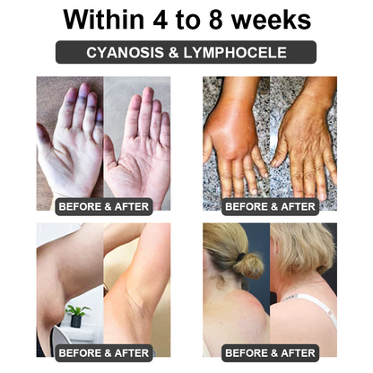 𝐅𝐮𝐭𝐮𝐬𝐥𝐲™ 𝐔𝐥𝐭𝐫𝐚𝐬𝐨𝐧𝐢𝐜 𝐂𝐚𝐯𝐢𝐭𝐚𝐭𝐢𝐨𝐧 & 𝐃𝐞𝐭𝐨𝐱𝐢𝐟𝐢𝐜𝐚𝐭𝐢𝐨𝐧 𝐖𝐫𝐢𝐬𝐭𝐛𝐚𝐧𝐝 (👨‍⚕️𝐑𝐞𝐜𝐨𝐦𝐦𝐞𝐧𝐝𝐞𝐝 𝐛𝐲 𝐏𝐥𝐚𝐬𝐭𝐢𝐜 𝐒𝐮𝐫𝐠𝐞𝐨𝐧𝐬)