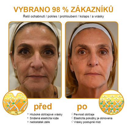 🔥🔥Vyrobeno a odesláno z Česká republika ✅ PLTOWE™ Botoxový včelím jedem odstranění vrásek krém - poslední den propagace 70% sleva