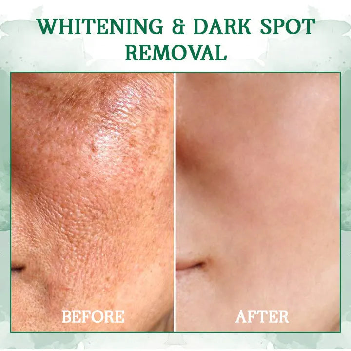 Last Day Promotion 80%OFF -Fubsta™SkinFirming Rejuvenating Serum