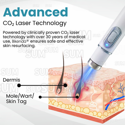✨Bikenda®Non-Invasive Skin Imperfection Removal Pen✨