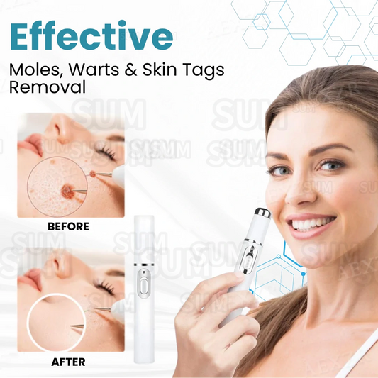 ✨Bikenda®Non-Invasive Skin Imperfection Removal Pen✨