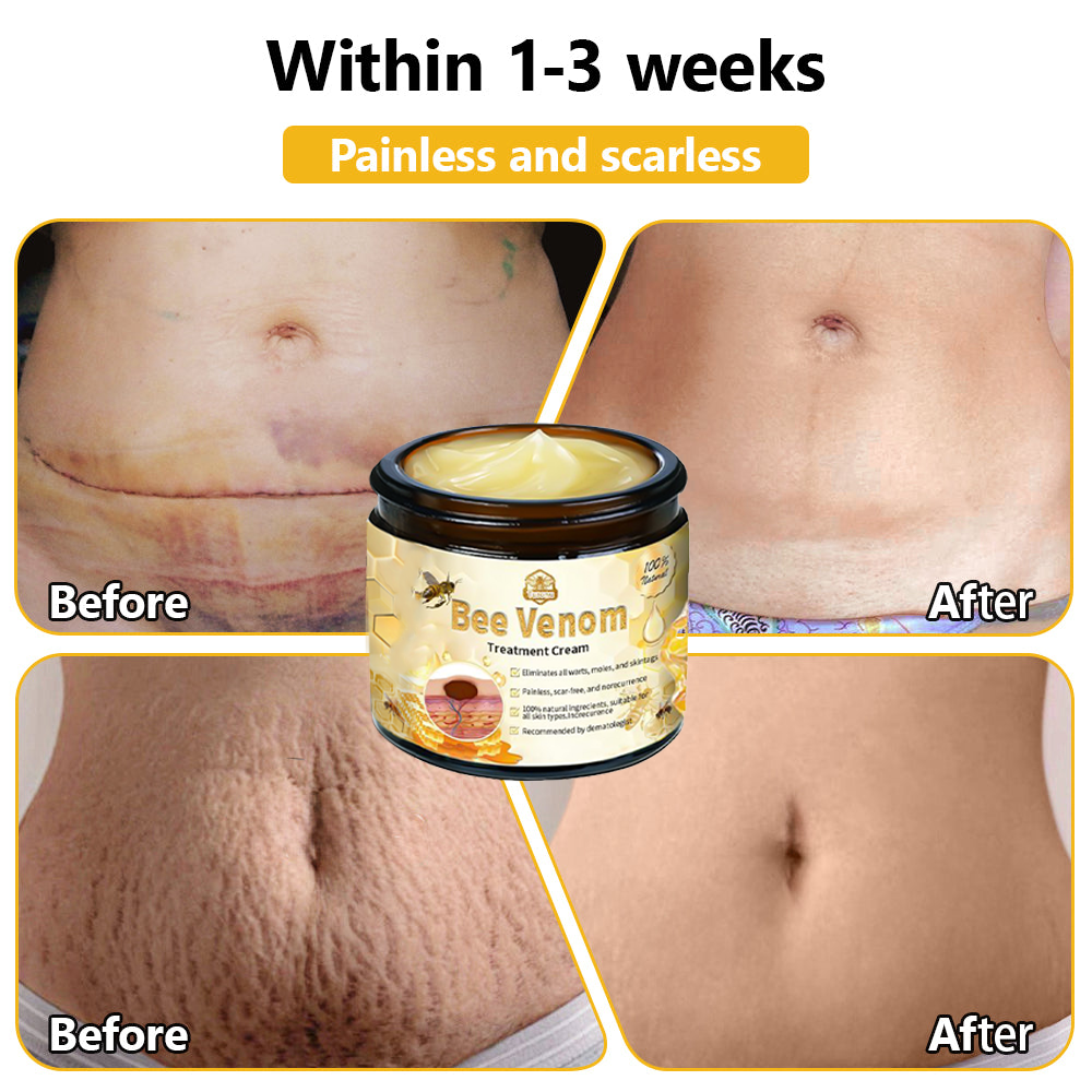 Tnnedey™ Bee Venom🐝 Skin Treatment Cream (AAD Recommended) ✨💆‍♀️ (Expert Recommended)