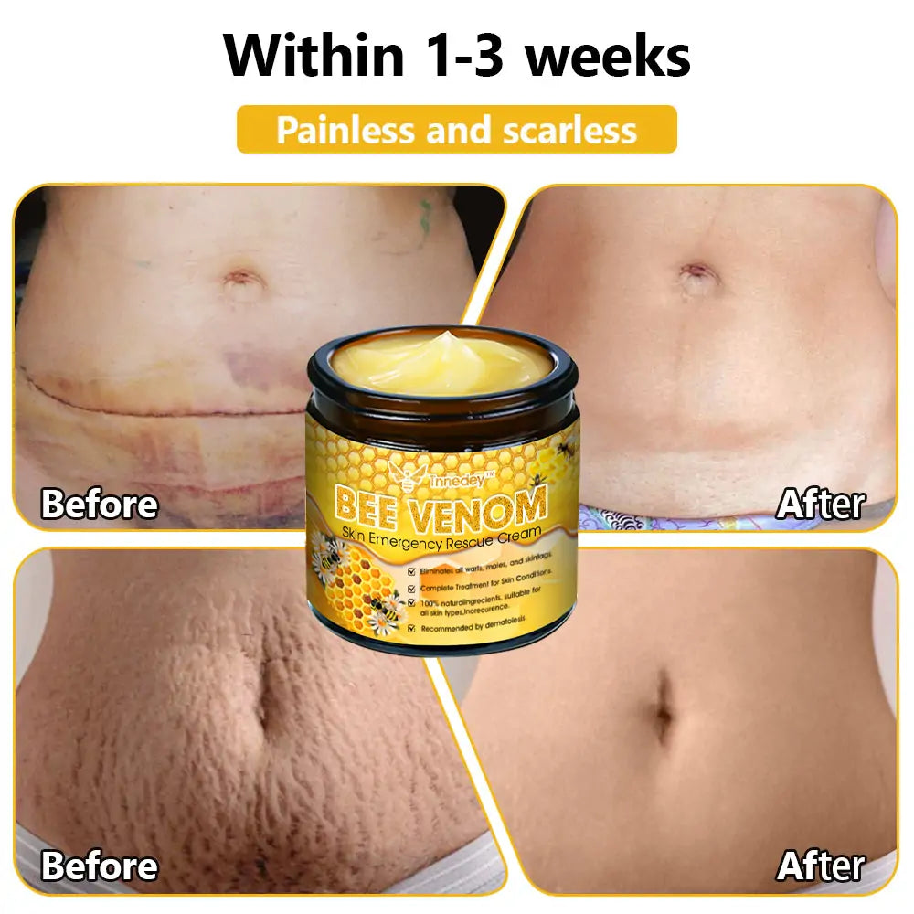 Tnnedey™ Bee Venom Skin Emergency Rescue Cream (AAD Recommended) 💆‍♀️ Expert Recommended for Ultimate Skin Revival ✨