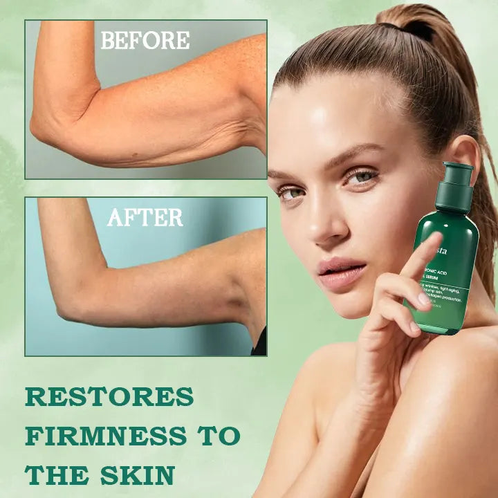 Last Day Promotion 80%OFF -Fubsta™SkinFirming Rejuvenating Serum