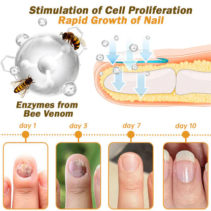 𝐓𝐧𝐧𝐞𝐝𝐞𝐲® Bee Venom Toenail Fungus Treatment Solution🐝💅 - Say Goodbye to Nail Fungus✨