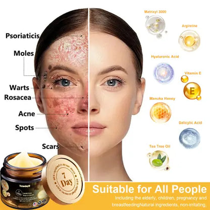 𝐓𝐧𝐧𝐞𝐝𝐞𝐲® 7-Day Multi-Effect All-in-One Skincare Cream [AAD Recommended]🌻🧖‍♀️
