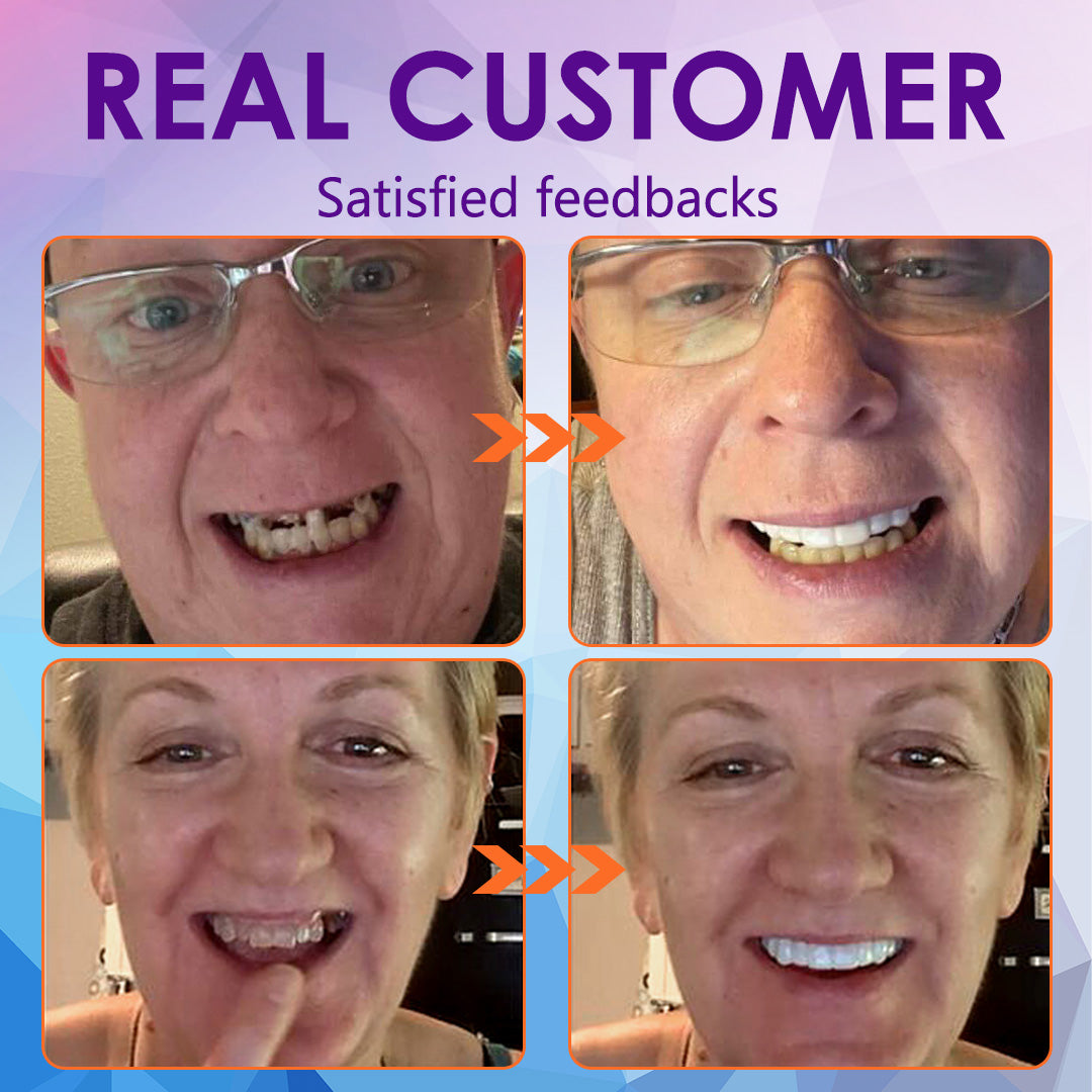 𝐁𝐢𝐤𝐞𝐧𝐝𝐚™ Silicone Reline Denture Set (⏰ Limited Time Discount Last 30 Minutes ⏰)CED🦷