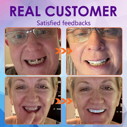 𝐁𝐢𝐤𝐞𝐧𝐝𝐚™ Silicone Reline Denture Set (⏰ Limited Time Discount Last 30 Minutes ⏰)CED🦷