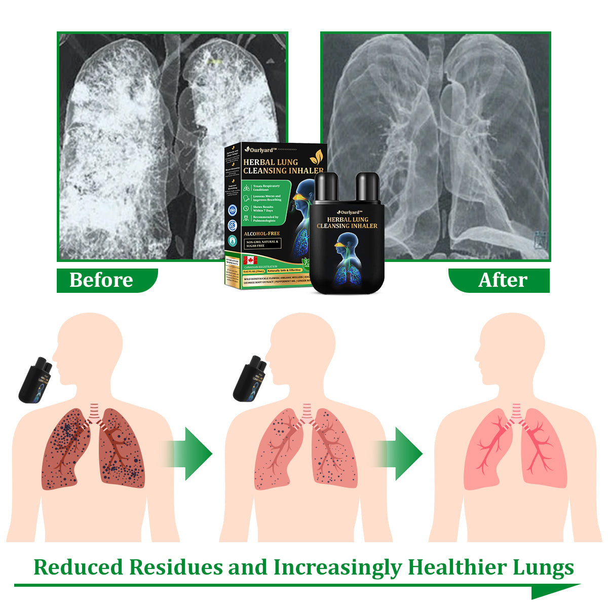 💖✅Official Store:tnnedey™ Herbal Lung Cleansing Inhaler (💝 Cough, wheezing, shortness of breath, sputum, stuffy nose, bronchitis, bronchitis, allergy symptoms, lung discomfort💝)