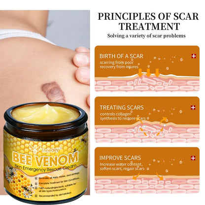 Tnnedey™ Bee Venom Skin Emergency Rescue Cream (AAD Recommended) 💆‍♀️ Expert Recommended for Ultimate Skin Revival ✨