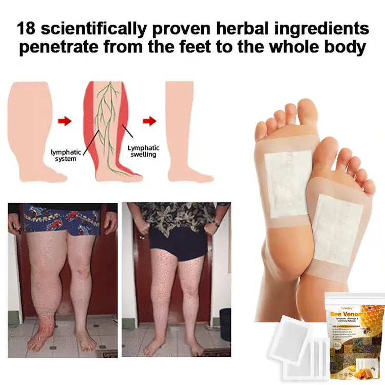 Tnnedey™ Bee Venom 𝐋𝐲𝐦𝐩𝐡𝐚𝐭𝐢𝐜 𝐃𝐫𝐚𝐢𝐧𝐚𝐠𝐞 & 𝐒𝐥𝐢𝐦𝐦𝐢𝐧𝐠 Foot Patches - 𝐓𝐚𝐫𝐠𝐞𝐭 𝐒𝐰𝐞𝐥𝐥𝐢𝐧𝐠 & 𝐃𝐞𝐭𝐨𝐱 𝐍𝐚𝐭𝐮𝐫𝐚𝐥𝐥𝐲🌿👣