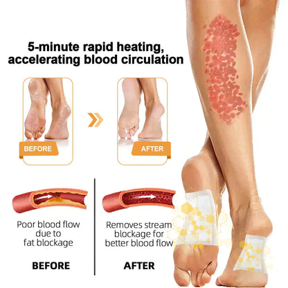 Tnnedey™ Bee Venom 𝐋𝐲𝐦𝐩𝐡𝐚𝐭𝐢𝐜 𝐃𝐫𝐚𝐢𝐧𝐚𝐠𝐞 & 𝐒𝐥𝐢𝐦𝐦𝐢𝐧𝐠 Foot Patches - 𝐓𝐚𝐫𝐠𝐞𝐭 𝐒𝐰𝐞𝐥𝐥𝐢𝐧𝐠 & 𝐃𝐞𝐭𝐨𝐱 𝐍𝐚𝐭𝐮𝐫𝐚𝐥𝐥𝐲🌿👣