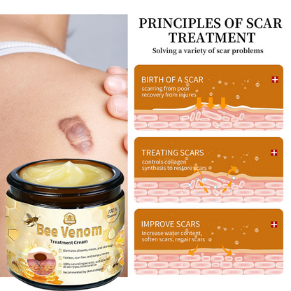 Tnnedey™ Bee Venom🐝 Skin Treatment Cream (AAD Recommended) ✨💆‍♀️ (Expert Recommended)