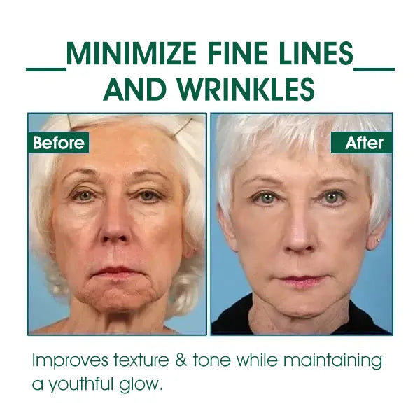Last Day Promotion 80%OFF -Fubsta™SkinFirming Rejuvenating Serum