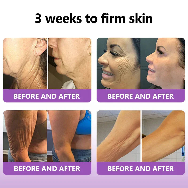 [OFFICIAL STORE] Fubsta® Skin Firming Tighten Lift Reducing Body Cream – Restore Elasticity & Achieve Youthful, Glowing Skin! ✨🌺