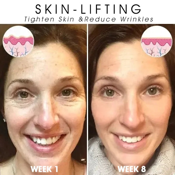 Last Day Promotion 80%OFF -Fubsta™SkinFirming Rejuvenating Serum