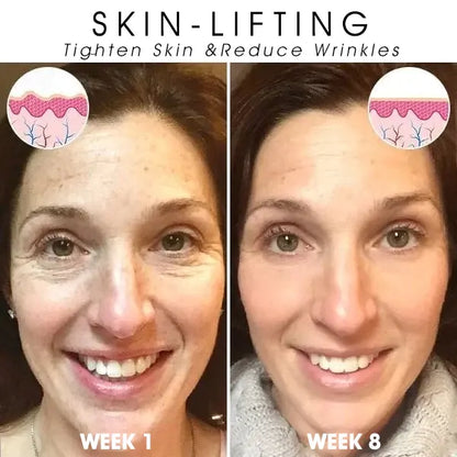 Last Day Promotion 80%OFF -Fubsta™SkinFirming Rejuvenating Serum