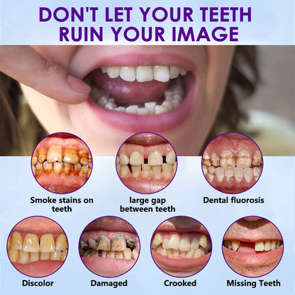 𝐁𝐢𝐤𝐞𝐧𝐝𝐚™ Silicone Reline Denture Set (⏰ Limited Time Discount Last 30 Minutes ⏰)CED🦷