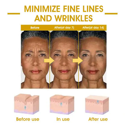 𝐋𝐚𝐬𝐭 𝐃𝐚𝐲 𝐃𝐢𝐬𝐜𝐨𝐮𝐧𝐭: 75% 𝐎𝐅𝐅✨𝐅𝐮𝐛𝐬𝐭𝐚® SkinFirming Rejuvenating Oil 💛