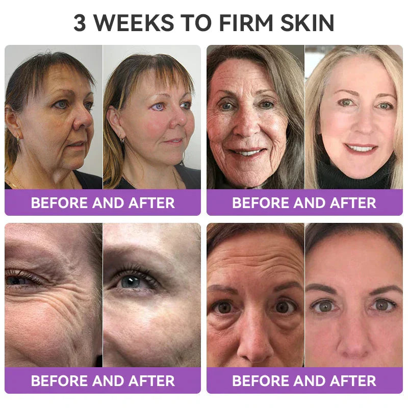 [OFFICIAL STORE] Fubsta® Skin Firming Tighten Lift Reducing Body Cream – Restore Elasticity & Achieve Youthful, Glowing Skin! ✨🌺