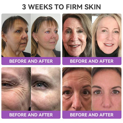 [OFFICIAL STORE] Fubsta® Skin Firming Tighten Lift Reducing Body Cream – Restore Elasticity & Achieve Youthful, Glowing Skin! ✨🌺