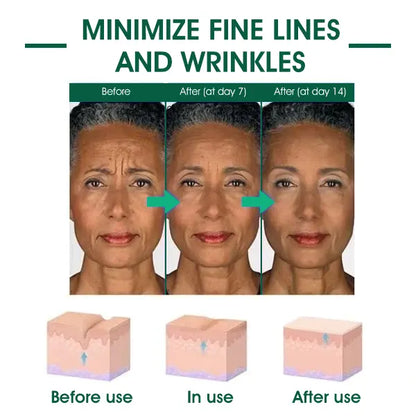 Last Day Promotion 80%OFF -Fubsta™SkinFirming Rejuvenating Serum