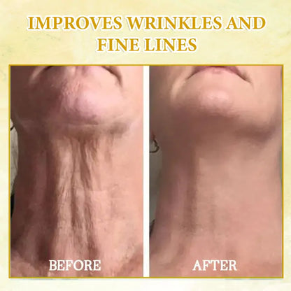 𝐋𝐚𝐬𝐭 𝐃𝐚𝐲 𝐃𝐢𝐬𝐜𝐨𝐮𝐧𝐭: 75% 𝐎𝐅𝐅✨𝐅𝐮𝐛𝐬𝐭𝐚® SkinFirming Rejuvenating Oil 💛