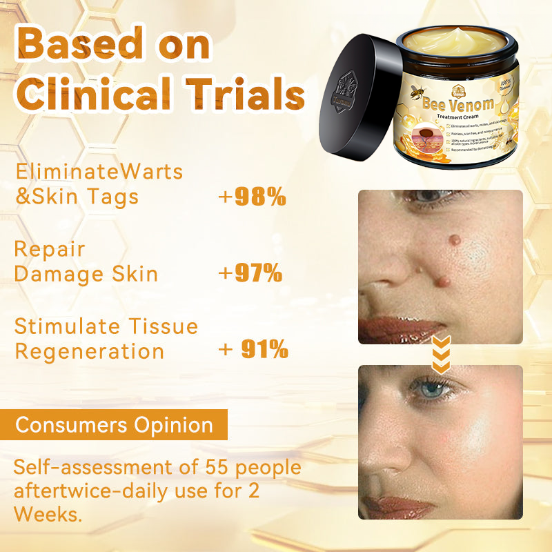 Tnnedey™ Bee Venom🐝 Skin Treatment Cream (AAD Recommended) ✨💆‍♀️ (Expert Recommended)
