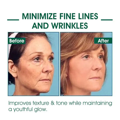 Last Day Promotion 80%OFF -Fubsta™SkinFirming Rejuvenating Serum