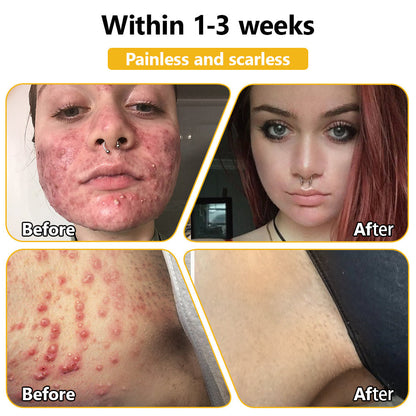 Tnnedey™ Bee Venom🐝 Skin Treatment Cream (AAD Recommended) ✨💆‍♀️ (Expert Recommended)