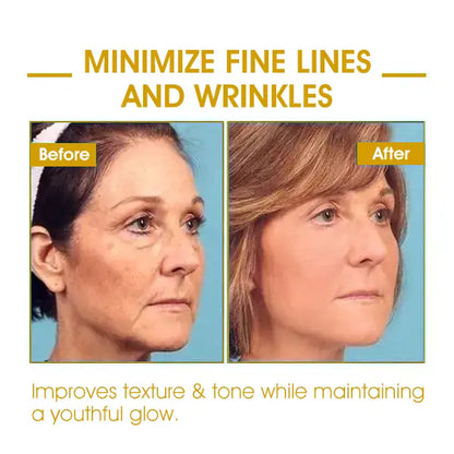 𝐋𝐚𝐬𝐭 𝐃𝐚𝐲 𝐃𝐢𝐬𝐜𝐨𝐮𝐧𝐭: 75% 𝐎𝐅𝐅✨𝐅𝐮𝐛𝐬𝐭𝐚® SkinFirming Rejuvenating Oil 💛