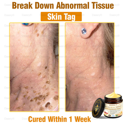 CVS Pharmacy: Daasry® Botox Bee Venom Skin Treatment Cream Approved by AAD