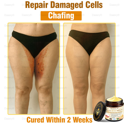 CVS Pharmacy: Daasry® Botox Bee Venom Skin Treatment Cream Approved by AAD