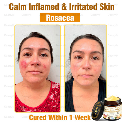 CVS Pharmacy: Daasry® Botox Bee Venom Skin Treatment Cream Approved by AAD