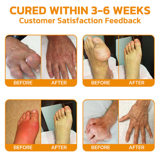 𝐓𝐧𝐧𝐞𝐝𝐞𝐲® Bee Venom Pain Suppression Joint Healing Cream (👩🏼‍⚕️COA Recommended)🔥🐝