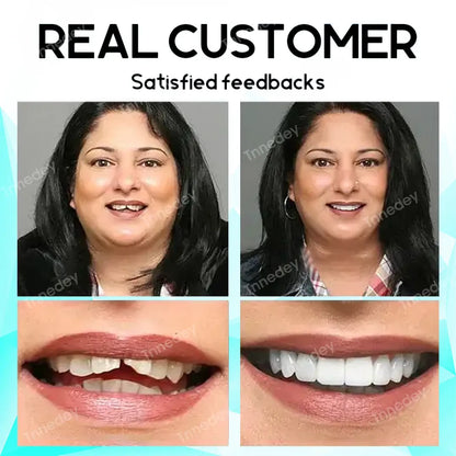𝐋𝐚𝐬𝐭 𝐃𝐚𝐲 𝐃𝐢𝐬𝐜𝐨𝐮𝐧𝐭 - 𝟕𝟓% 𝐎𝐟𝐟 🎊Newest 2025 𝐓𝐧𝐧𝐞𝐝𝐞𝐲® Adjustable Snap-On Dentures✅🦷