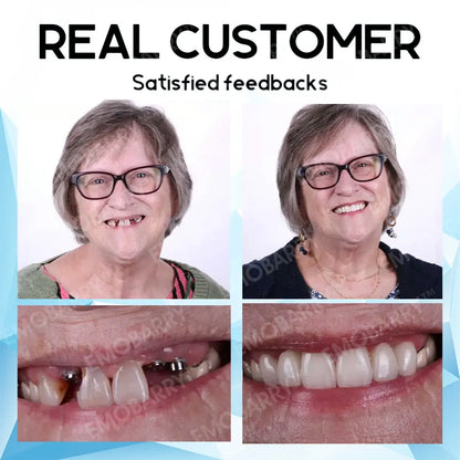 Bikenda™ Premium Custom Silicone Denture Set 💎✨ ADA (American Dental Association) Certified 🏅 Limited Time Discount   Unlock a Perfect Smile 😁🦷 with our ADA-certified silicone dentures!