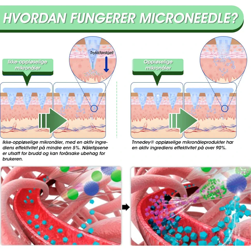 [Versjon 2025 med oppgraderinger] Tnnedey® 𝐋𝐚𝐥𝐮𝐭𝐢𝐝𝐞 (𝐒𝐚𝐱-𝐤𝐨𝐦𝐛𝐢𝐧𝐚𝐬𝐣𝐨𝐧) 𝐧𝐚𝐧𝐨 𝐦𝐢𝐤𝐫𝐨𝐧å𝐥-𝐩𝐚𝐭𝐜𝐡 (Uten smerte, langvarig, rettet mot diabetes, fedme og hjerte- og karsykdommer) 🔥