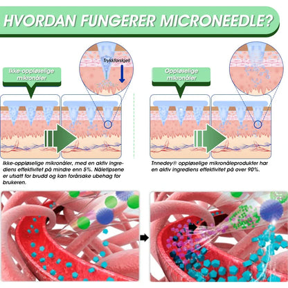 【Versjon 2025 med oppgraderinger】Tnnedey® 𝐋𝐚𝐥𝐮𝐭𝐢𝐝𝐞 (𝐒𝐚𝐱-𝐂𝐨𝐦𝐛𝐢𝐧𝐚𝐭𝐢𝐨𝐧) Nano Microneedle Patch (Uten smerte, langvarig, rettet mot diabetes, fedme og hjerte- og karsykdommer)