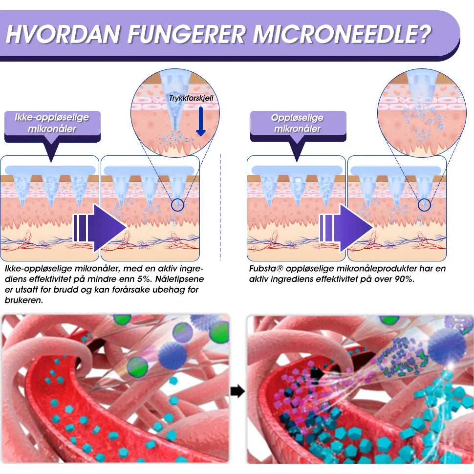 Fubsta® SMGT-GLP-1 Nano Microneedle Patch 2.0 (✅Smertefri, langvarig, som behandler diabetes, fedme og kardiovaskulære sykdommer) - 🔥Se resultater på 7 dager