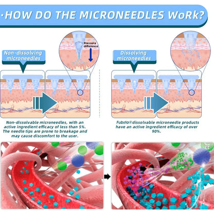 【Fubsta® Official Store】 NIDDK-Tirzepatide Nano Microneedle Patch （Zero Pain, 24/7 Release | Lose 20lbs FAST | 90% Sugar Drop | ）