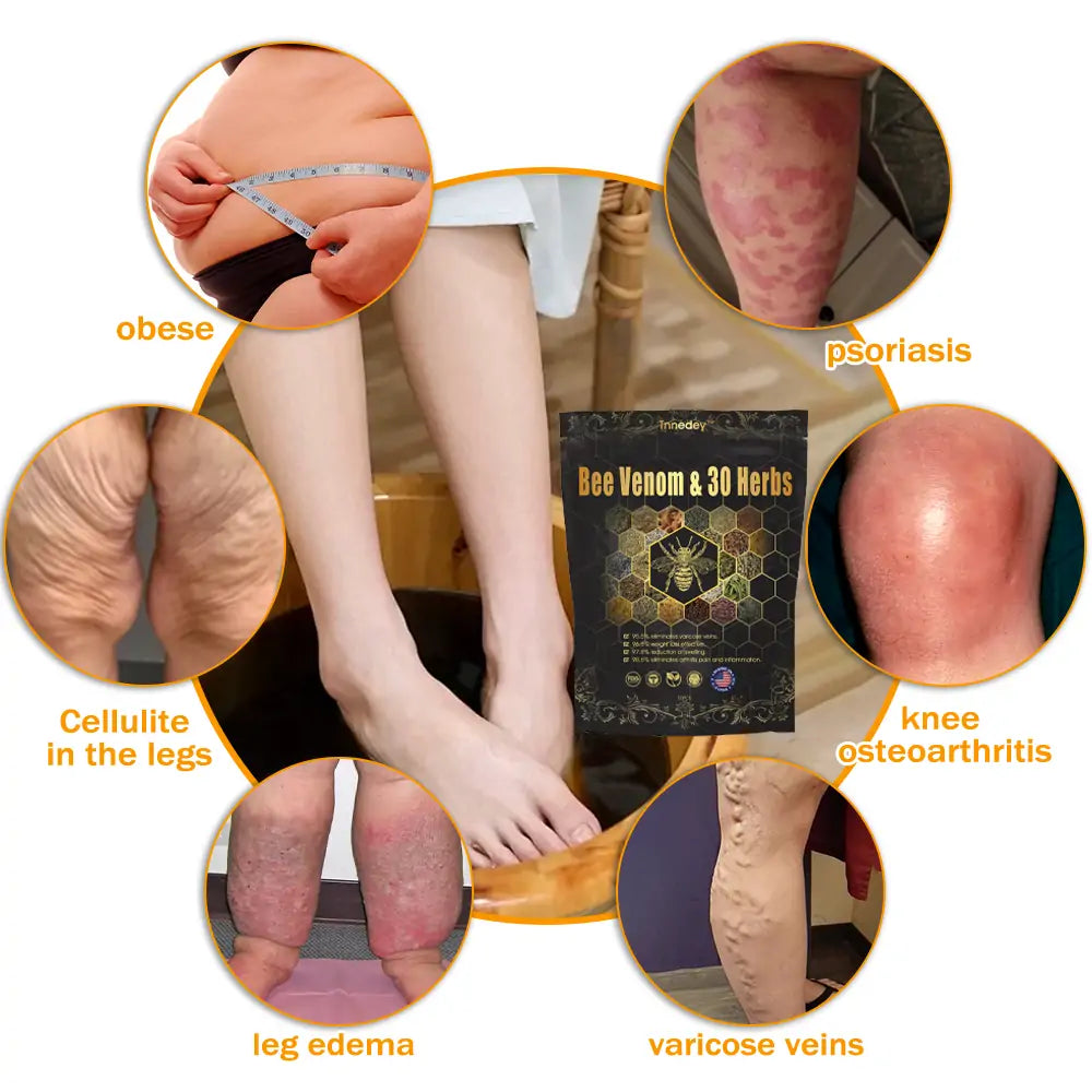 𝐂𝐡𝐫𝐢𝐬𝐭𝐦𝐚𝐬 𝐒𝐩𝐞𝐜𝐢𝐚𝐥: Tnnedey® Bee Venom & 30-Herb Detox Foot Soak Beads for 𝐁𝐨𝐝𝐲 𝐒𝐜𝐮𝐥𝐩𝐭𝐢𝐧𝐠 Recommended by the America 𝐋𝐲𝐦𝐩𝐡𝐚𝐭𝐢𝐜 Academy (ALA) 🎄✨