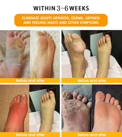 𝐂𝐡𝐫𝐢𝐬𝐭𝐦𝐚𝐬 𝐒𝐩𝐞𝐜𝐢𝐚𝐥: Tnnedey® Bee Venom & 30-Herb Detox Foot Soak Beads for 𝐁𝐨𝐝𝐲 𝐒𝐜𝐮𝐥𝐩𝐭𝐢𝐧𝐠 Recommended by the America 𝐋𝐲𝐦𝐩𝐡𝐚𝐭𝐢𝐜 Academy (ALA) 🎄✨